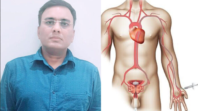 Prostatic artery embolization