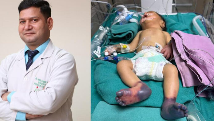 Doctors treated a premature newborn suffering from deadly gangrene.